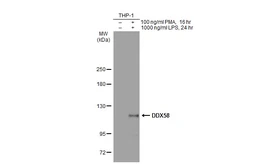 Anti-DDX58 antibody used in Western Blot (WB). GTX132517