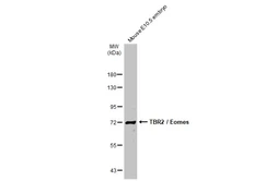 Anti-TBR2 / Eomes antibody used in Western Blot (WB). GTX132776