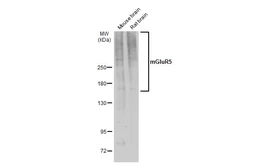 Anti-mGluR5 antibody used in Western Blot (WB). GTX132899