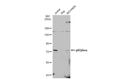 Anti-p67phox antibody used in Western Blot (WB). GTX132967