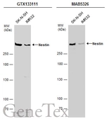Anti-Nestin antibody used in Western Blot (WB). GTX133111