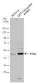 Anti-PAX2 antibody used in Western Blot (WB). GTX133116