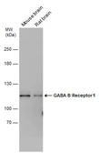 Anti-GABA B Receptor 1 antibody used in Western Blot (WB). GTX133165