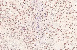 Anti-NeuroD1 antibody used in IHC (Paraffin sections) (IHC-P). GTX133207