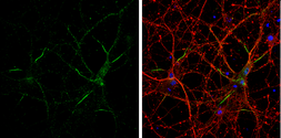 Anti-Neurofascin antibody used in Immunocytochemistry/ Immunofluorescence (ICC/IF). GTX133266