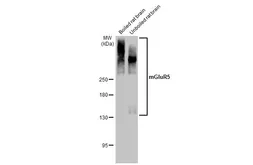 Anti-mGluR5 antibody used in Western Blot (WB). GTX133288