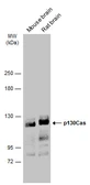 Anti-p130Cas antibody used in Western Blot (WB). GTX133337
