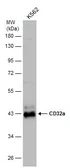 Anti-CD32 antibody used in Western Blot (WB). GTX133371