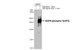 Anti-EGFR (phospho Tyr974) antibody used in Western Blot (WB). GTX133427