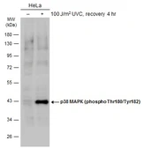 Anti-p38 MAPK (phospho Thr180/Tyr182) antibody used in Western Blot (WB). GTX133460