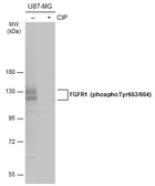Anti-FGFR1 (phospho Tyr653/654) antibody used in Western Blot (WB). GTX133526