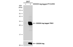 Anti-TMS1 antibody used in Western Blot (WB). GTX133581