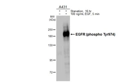 Anti-EGFR (phospho Tyr974) antibody used in Western Blot (WB). GTX133601