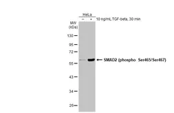 Anti-SMAD2 (phospho Ser465/Ser467) antibody used in Western Blot (WB). GTX133614