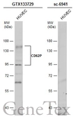Anti-CD62P antibody used in Western Blot (WB). GTX133729