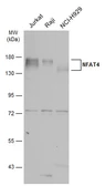 Anti-NFAT4 antibody used in Western Blot (WB). GTX133744