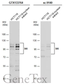 Anti-SKI antibody used in Western Blot (WB). GTX133764