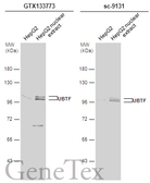 Anti-UBTF antibody used in Western Blot (WB). GTX133773