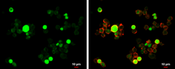 Anti-GFI1 antibody used in Immunocytochemistry/ Immunofluorescence (ICC/IF). GTX133807