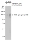 Anti-PYK2 (phospho Tyr402) antibody used in Western Blot (WB). GTX133940
