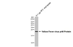 Anti-Yellow Fever virus prM Protein antibody used in Western Blot (WB). GTX133957