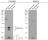 Anti-Doublecortin antibody used in Western Blot (WB). GTX134052