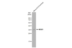 Anti-MSX1 antibody used in Western Blot (WB). GTX134078