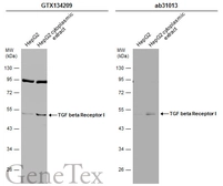 Anti-TGF beta Receptor I antibody used in Western Blot (WB). GTX134209