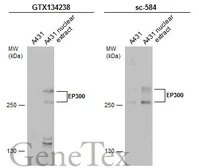 Anti-EP300 antibody used in Western Blot (WB). GTX134238