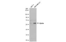 Anti-Ajuba antibody used in Western Blot (WB). GTX134670