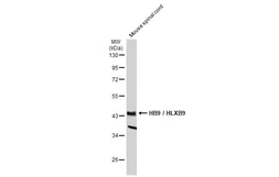 Anti-HB9 / HLXB9 antibody used in Western Blot (WB). GTX134781