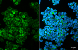 Anti-HLA-DQA1 antibody used in Immunocytochemistry/ Immunofluorescence (ICC/IF). GTX135986