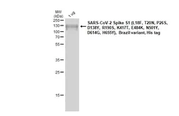 SARS-CoV-2 (COVID-19) Spike S1 Protein, P.1 / Gamma variant, His tag (active). GTX136094-pro