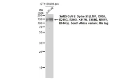 SARS-CoV-2 (COVID-19) Spike S1 Protein, B.1.351 / Beta variant, His tag (active). GTX136095-pro