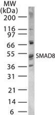 Anti-SMAD1+5+8(9) antibody used in Western Blot (WB). GTX13723