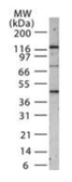 Anti-SMAD1+5+8(9) antibody used in Western Blot (WB). GTX13724