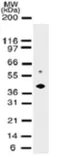 Anti-DNMT2 antibody [102B1259.2] used in Western Blot (WB). GTX13899