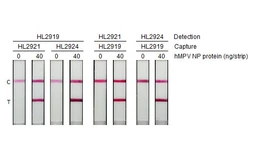 Human Metapneumovirus Nucleoprotein, DDDDK tag. GTX139078-pro