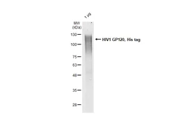 HIV1 gp120 protein, His tag. GTX139464-pro
