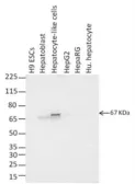 Anti-Alpha fetoprotein / AFP antibody [P5B8] used in Western Blot (WB). GTX15650