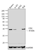 Anti-CD2 antibody [TS2/18] used in Western Blot (WB). GTX15668