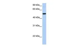 Anti-GALNT13 antibody, N-term used in Western Blot (WB). GTX16278