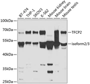 Anti-CP2c antibody used in Western Blot (WB). GTX16434