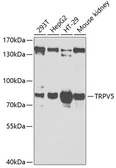 Anti-TRPV5 antibody used in Western Blot (WB). GTX16469
