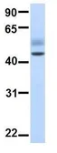 Anti-AADAC antibody, N-term used in Western Blot (WB). GTX16545