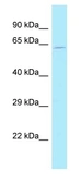 Anti-ACRBP antibody, N-term used in Western Blot (WB). GTX16546