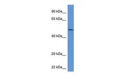 Anti-ACP2 antibody, Internal used in Western Blot (WB). GTX16580