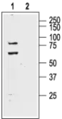Anti-KCND1 antibody used in Western Blot (WB). GTX16691