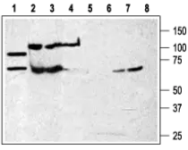 Anti-P2X7 antibody used in Western Blot (WB). GTX16827