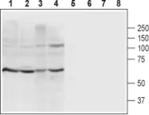 Anti-P2X4 antibody used in Western Blot (WB). GTX16929